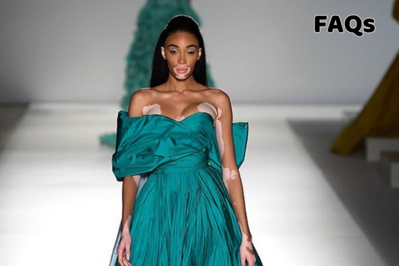 FAQs about Winnie Harlow