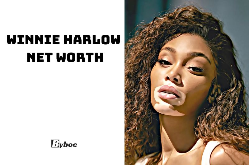 What is Winnie Harlow Net Worth 2023 Wiki, Age, Family, And More